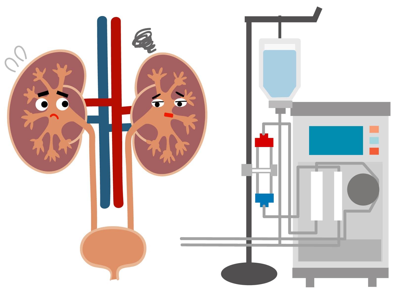 透析で働く看護師のメリット
